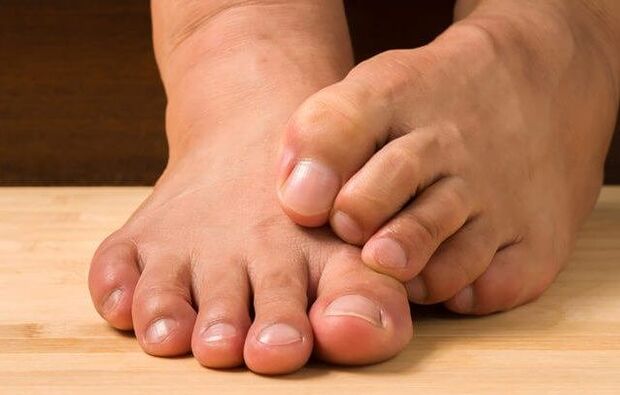foot fungus and medicines for its treatment